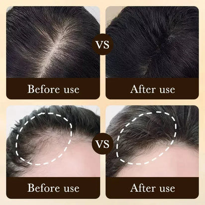 DERMACTIV HAIR GROWTH TREATMENT