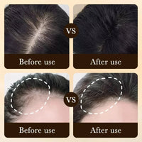 DERMACTIV HAIR GROWTH TREATMENT
